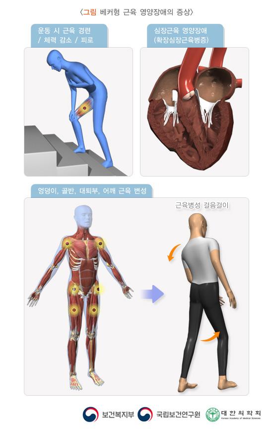 베커형 근육 영양장애의 증상