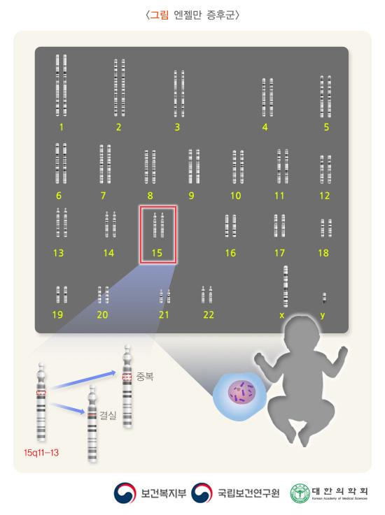 엔젤만 증후군: 15번 염색체의 장완에 위치(15q11-q13)하는 유전자 또는 유전자들의 중복이나 결손으로 일어난다고 생각되어짐