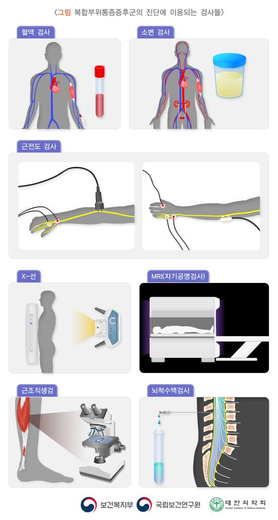 운동뉴런질환의 진단