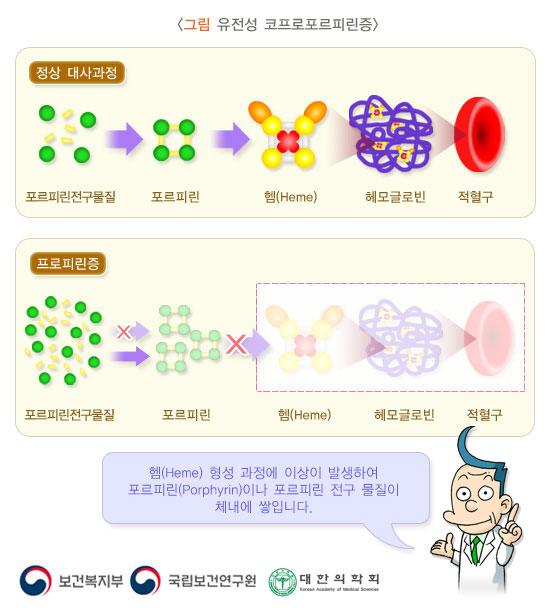 유전성 코프로포르피린증