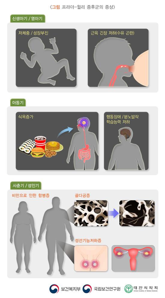 프라더-윌리 증후군의 증상