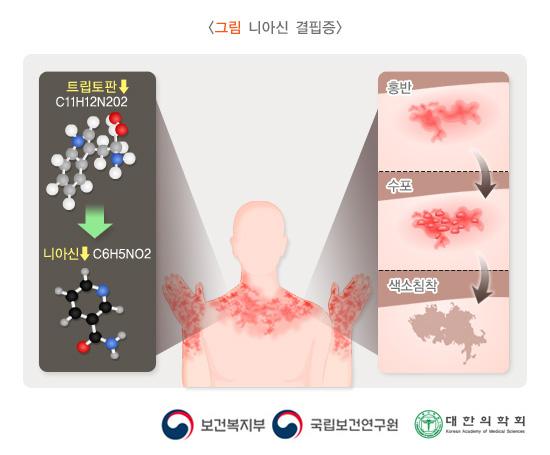니아신 결핍증 - from s05_123_니아신 결핍증