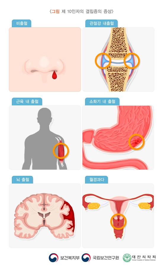 제10인자의 결핍증의 증상