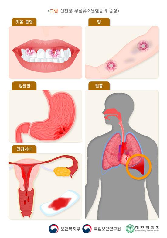 선천성 무섬유소원혈증의 증상