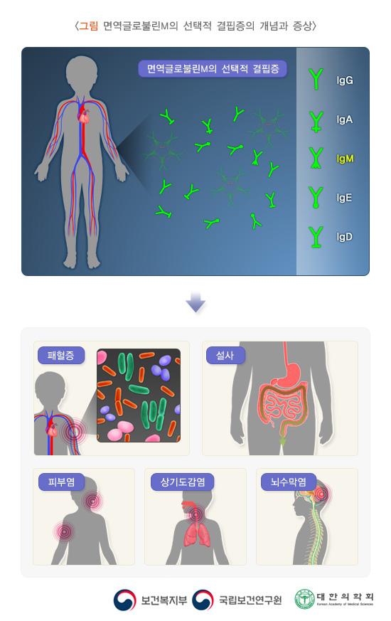 면역글로불린M의 선택적 결핍증의 개념과 증상