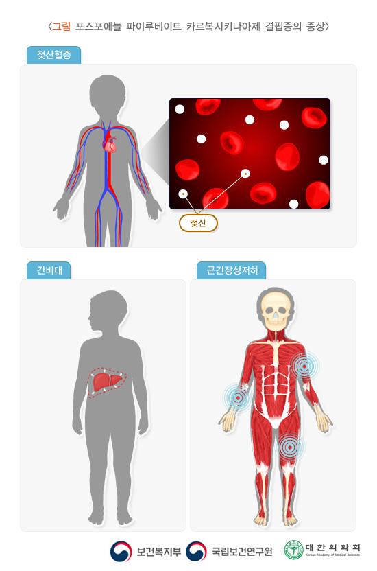 포스포에놀 파이루베이트 카르복시키나아제 결핍증의 증상