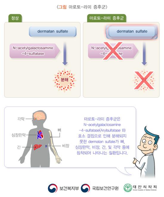 마로토-라미 증후군