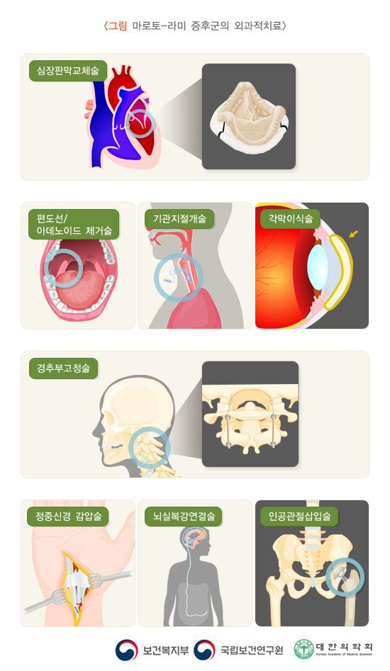 마로토-라미 증후군의 외과적치료