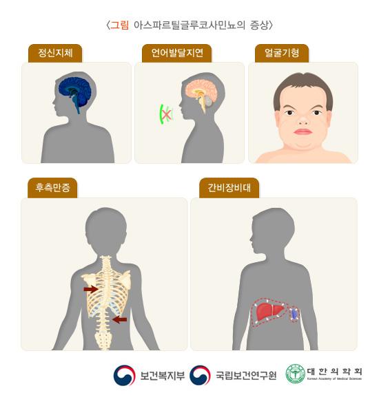 아스파르틸글루코사민뇨의 증상