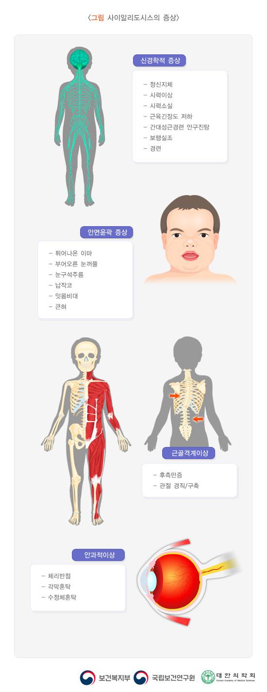 사이알리도시스의 증상