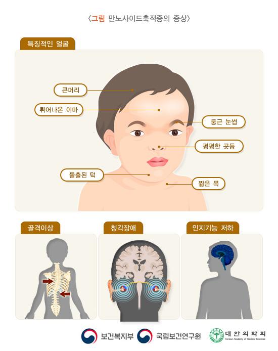 만노사이드축적증의 증상