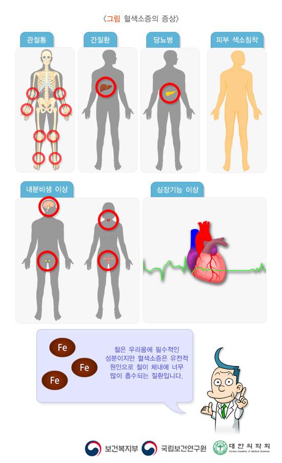 혈색소증의 증상