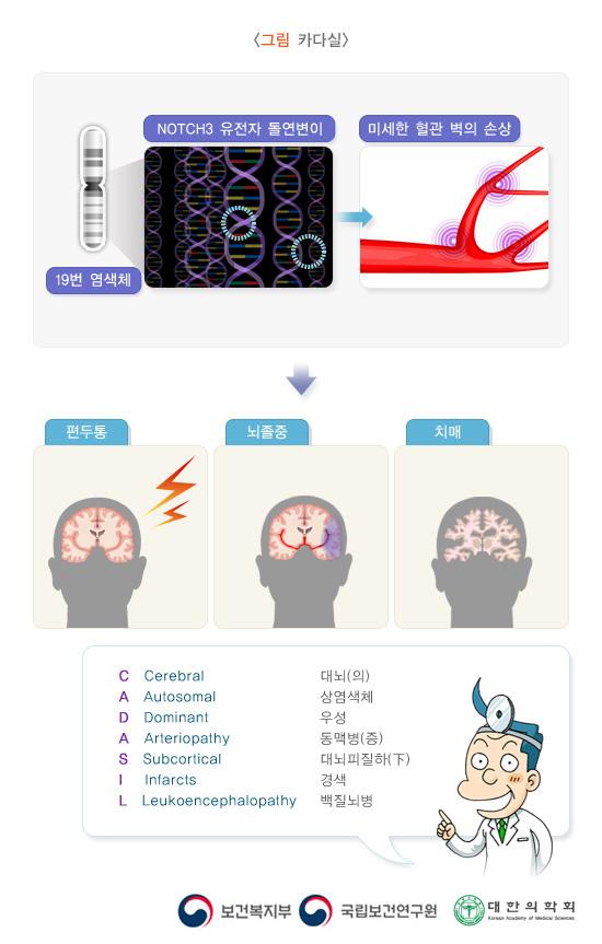 카다실: 염색체 19번의 NOTCH3 유전자의 다양한 돌연변이에 의해 나타나 미세한 혈관 벽의 손상을 일으킴으로써 편두통, 뇌졸중, 치매를 유발