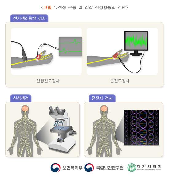 유전성 운동 및 감각 신경병증의 진단