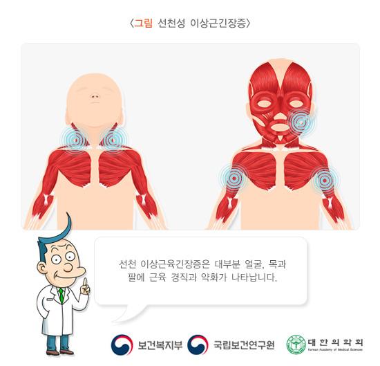 선천성 이상근긴장증