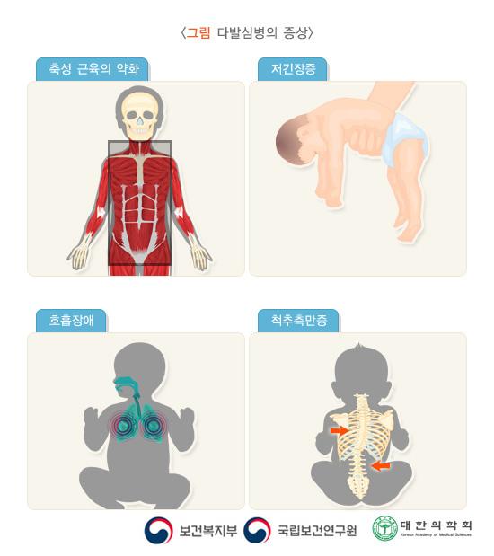 다발심병의 증상