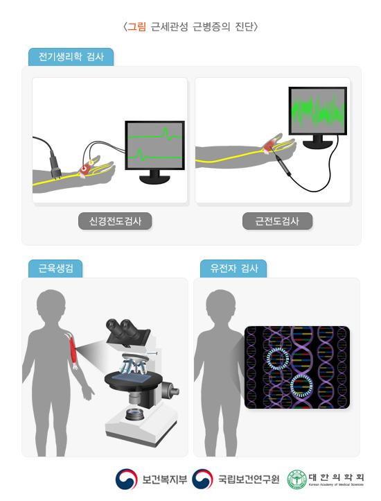 그림 근세관성 근병증의 진단. 전기생리학 검사. 신경전도검사, 근전도검사. 근육생검, 유전자 검사. 보건복지부, 국립보건연구원, 대한의학회