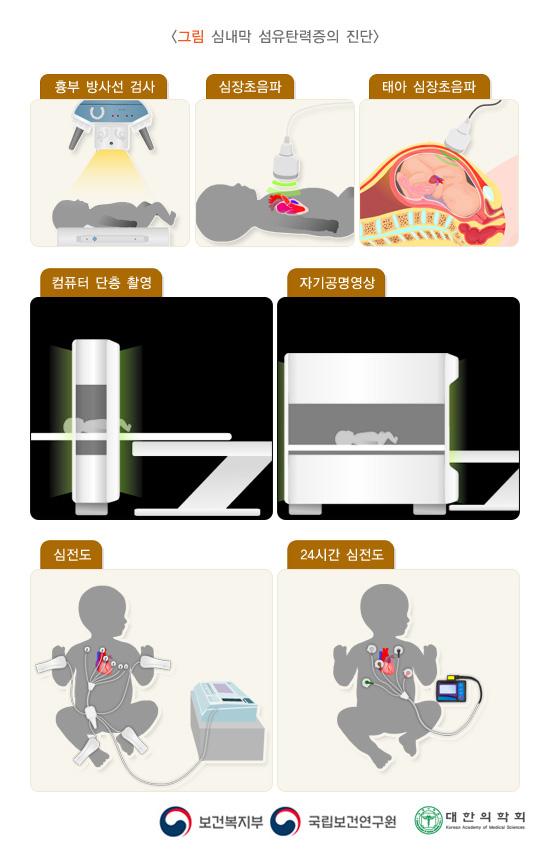 심내막 섬유탄력증의 진단 방법 그림. 흉부 방사선 검사, 심장초음파, 태아 심장초음파, 컴퓨터 단층 촬영, 자기공명영상, 심전도, 24시간 심전도. 보건복지부, 국립보건연구원, 대한의학회