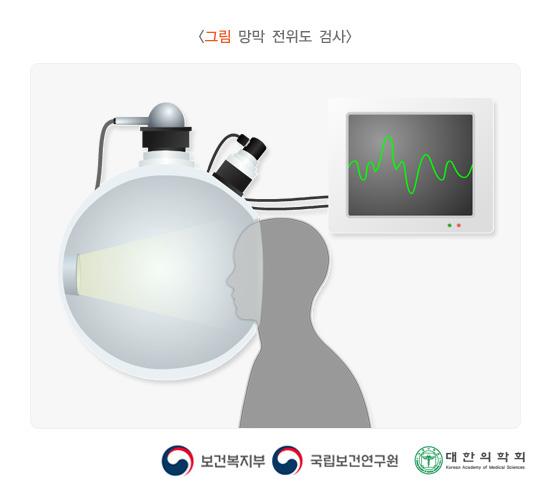 망막 전위도 검사