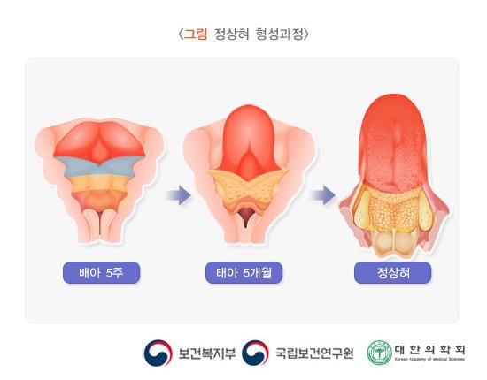정상혀 형성과정