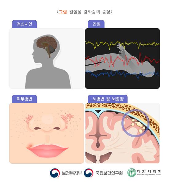 결절성 경화증의 증상